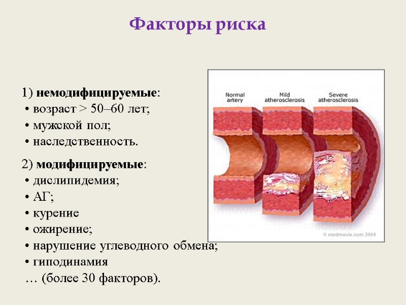 Факторы риска 1) немодифицируемые:  • возраст > 50–60 лет;  • мужской пол;